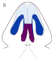 Medial Crura - Base View