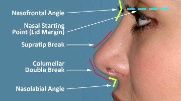 Glossary Of Terms Commonly Used In Primary Revision Rhinoplasty