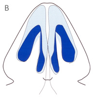 Alar (Tip) Cartilages - Base View